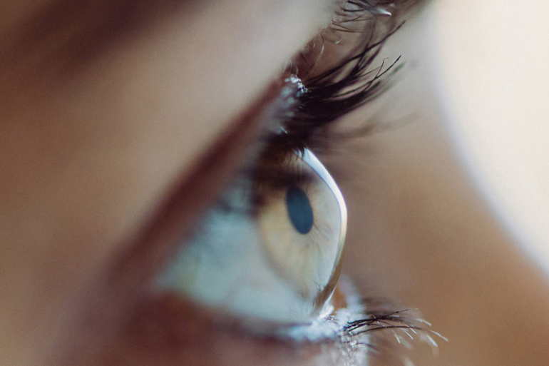 Наиболее распространенным симптомом кератоконуса является небольшое помутнение зрения или плохое прогрессирующее зрение, которое нелегко исправить